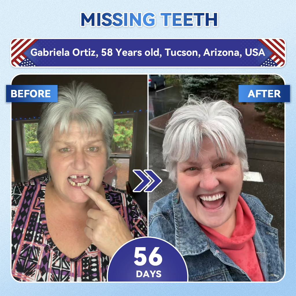 Lomelys® ✅ Tideglusib Fast‑Dissolving Tooth & Gum Repair Oral Strips 🦷 (Supports tooth repair and helps relieve gum discomfort and other common oral concerns)