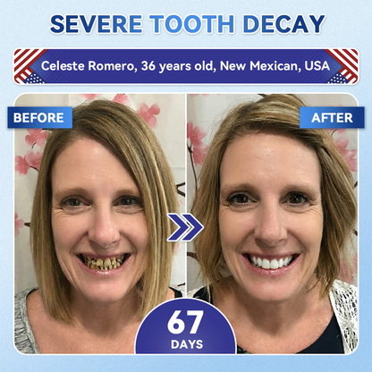 Lomelys® ✅ Tideglusib Fast‑Dissolving Tooth & Gum Repair Oral Strips 🦷 (Supports tooth repair and helps relieve gum discomfort and other common oral concerns)
