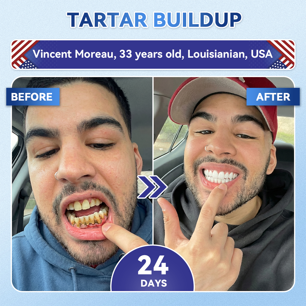 Lomelys® ✅ Tideglusib Fast‑Dissolving Tooth & Gum Repair Oral Strips 🦷 (Supports tooth repair and helps relieve gum discomfort and other common oral concerns)