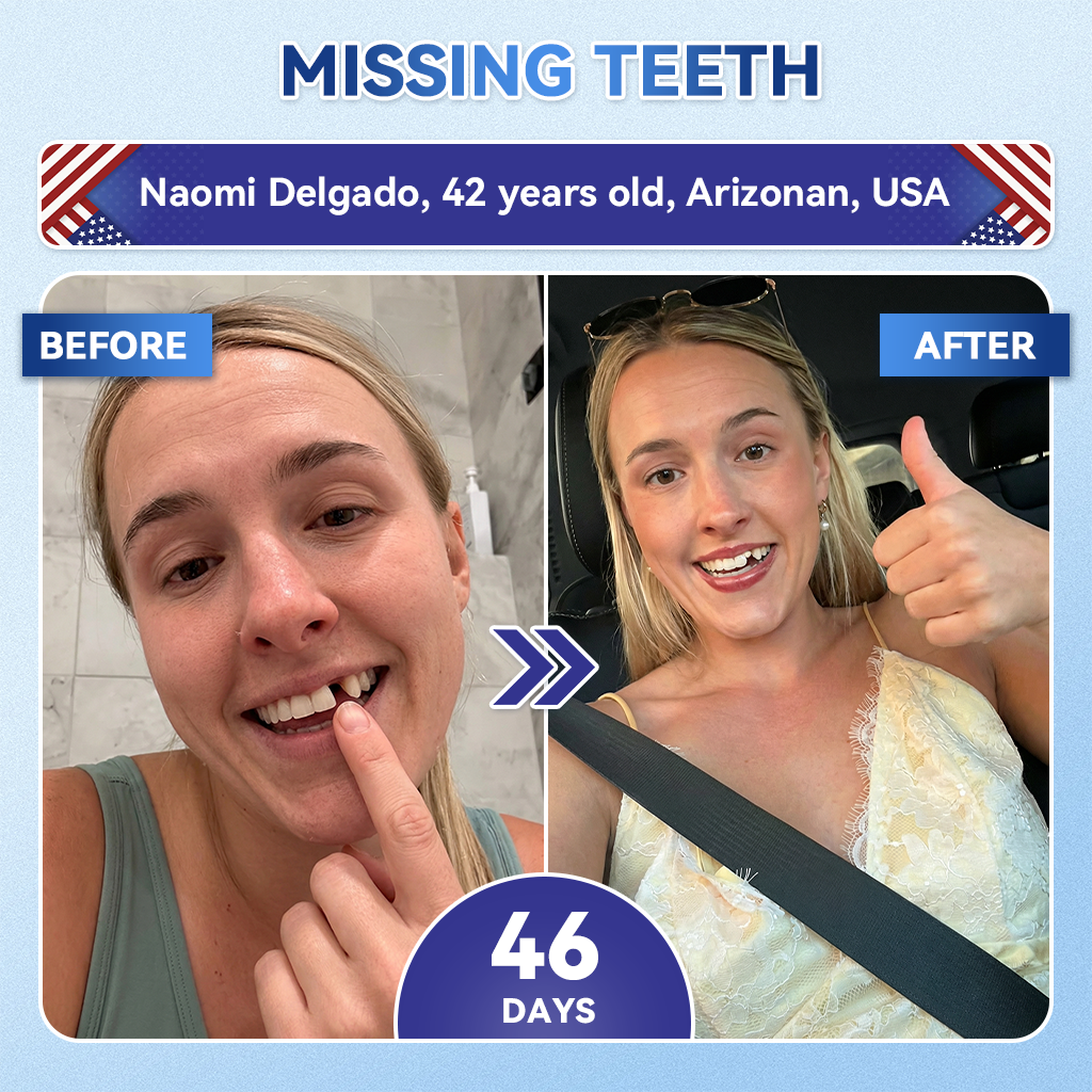 Lomelys® ✅ Tideglusib Fast‑Dissolving Tooth & Gum Repair Oral Strips 🦷 (Supports tooth repair and helps relieve gum discomfort and other common oral concerns)
