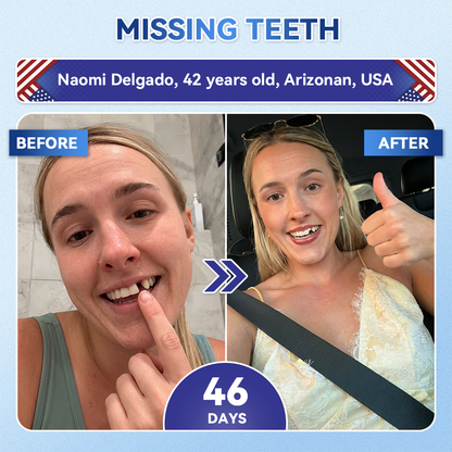 Lomelys® ✅ Tideglusib Fast‑Dissolving Tooth & Gum Repair Oral Strips 🦷 (Supports tooth repair and helps relieve gum discomfort and other common oral concerns)
