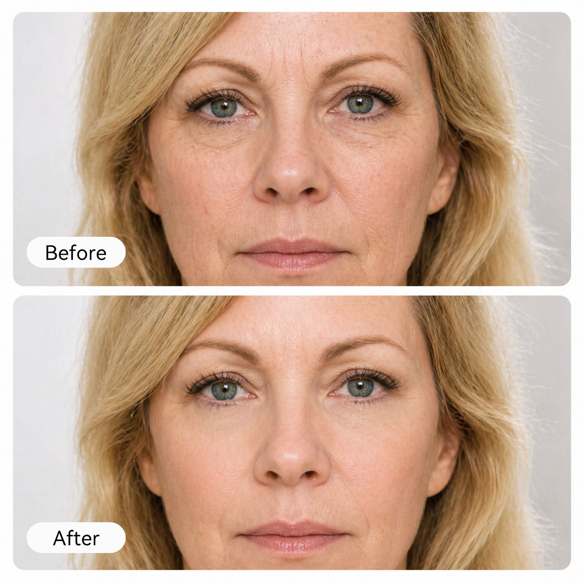 Restore a Firmer, Smoother Look — From Face to Neck✨