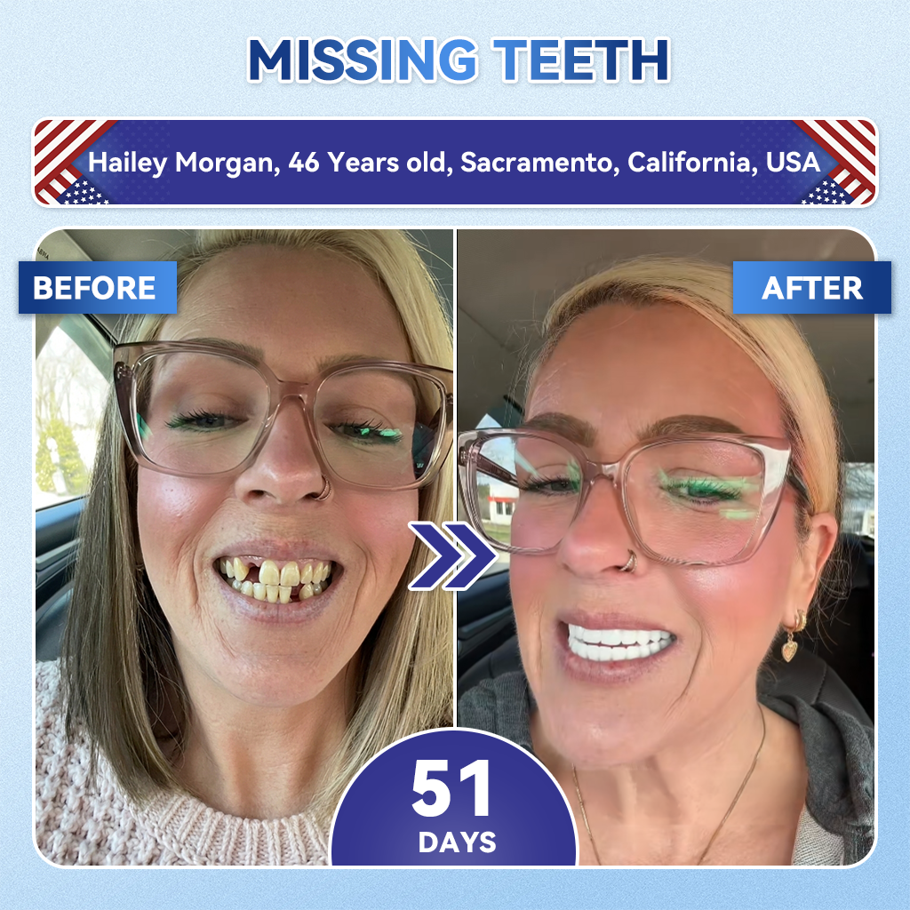 Lomelys® ✅ Tideglusib Fast‑Dissolving Tooth & Gum Repair Oral Strips 🦷 (Supports tooth repair and helps relieve gum discomfort and other common oral concerns)